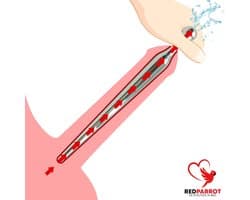 Urethra Dilator Penis Plug - RVS - Van Smal naar Breed - Medical Play Tool