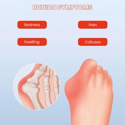 Orthopedische Sandalen - Dames Slippers - Comfortabel Lopen - Hoge Voetboog Steun - Platte Hak - Beige — thumbnail 5
