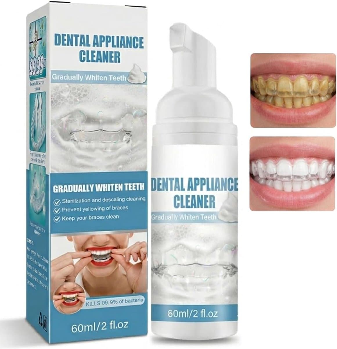 60 ml reiniging voor tandapparaten - ShopVlot — afbeelding 1