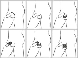 Set Penis- en Ballstrecher Ringen - Ball stretching Ringen - Set Cockringen in Diverse Maten - Cock&Ball Kit — thumbnail 5