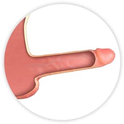 Real Body - Bodysuit - Female to Male - Mannelijk Onderlichaam met Holle Penis - Verkrijgbaar in 2 maten S/M — thumbnail 5