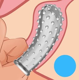 G-Spot Vinger sleeve Siliconen NR1 — thumbnail 4